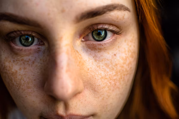 well health organic best ways to remove dark spots on face
